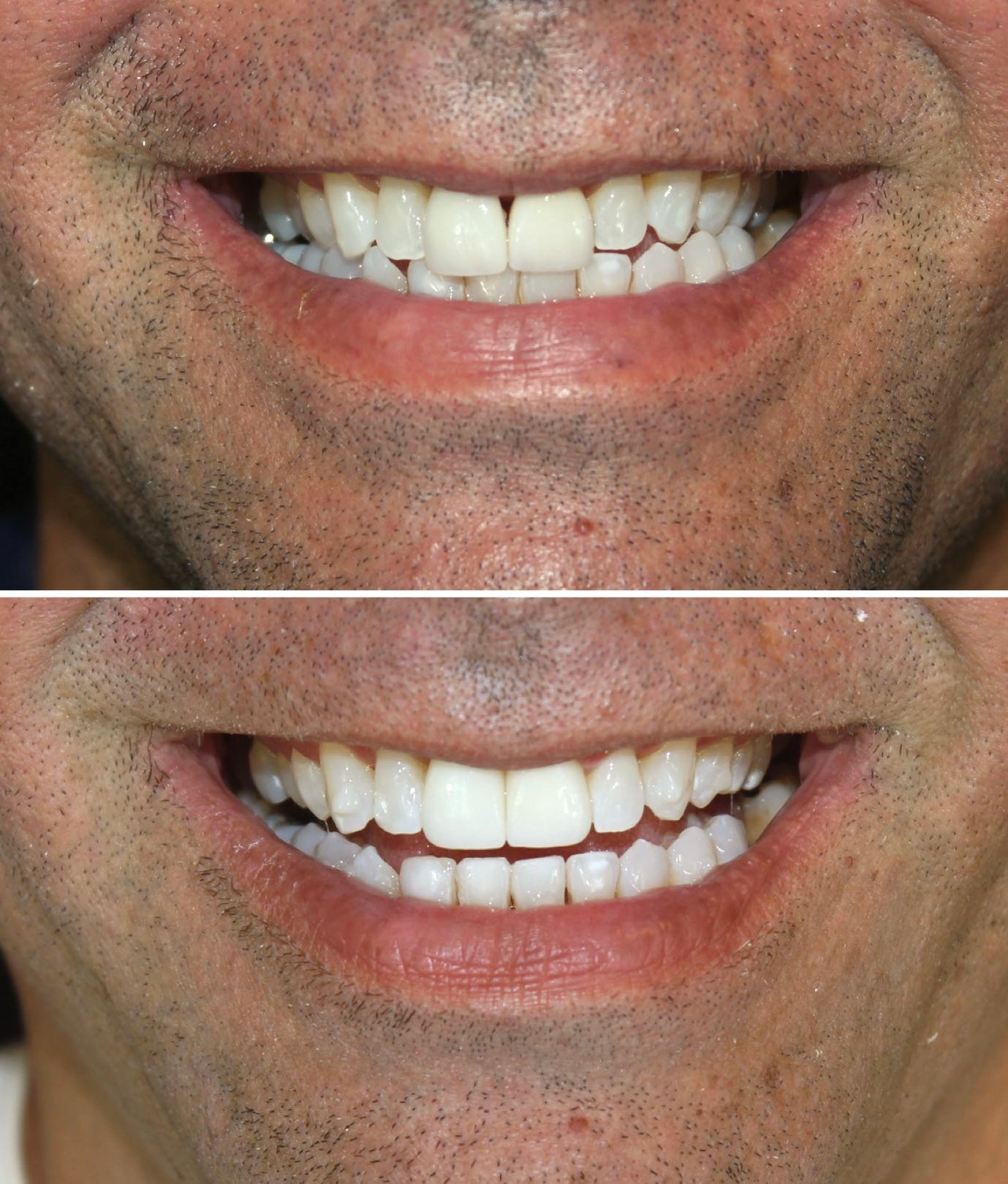 Resultado de tratamento odontológico — antes e depois