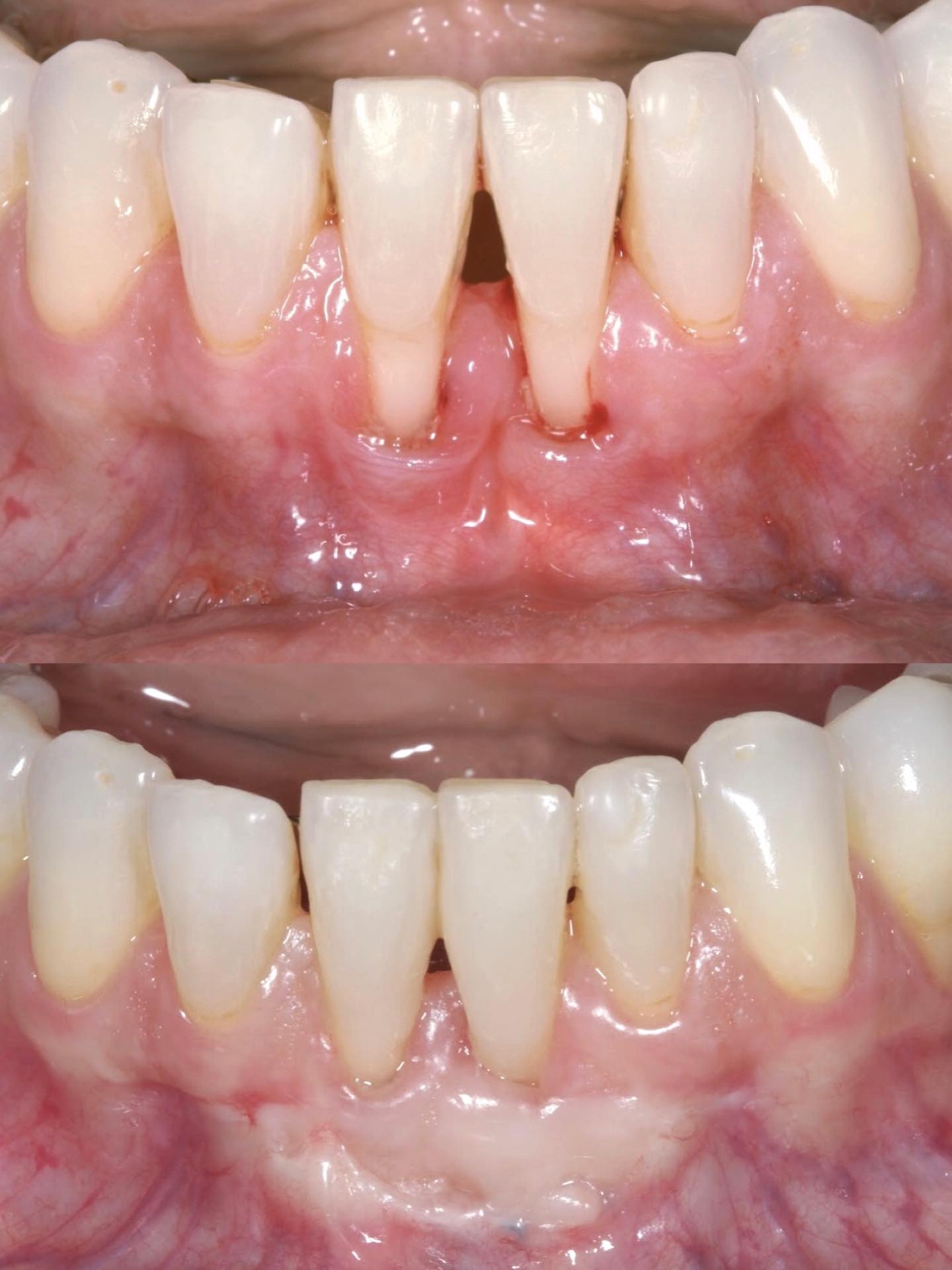 Resultado de tratamento odontológico — antes e depois