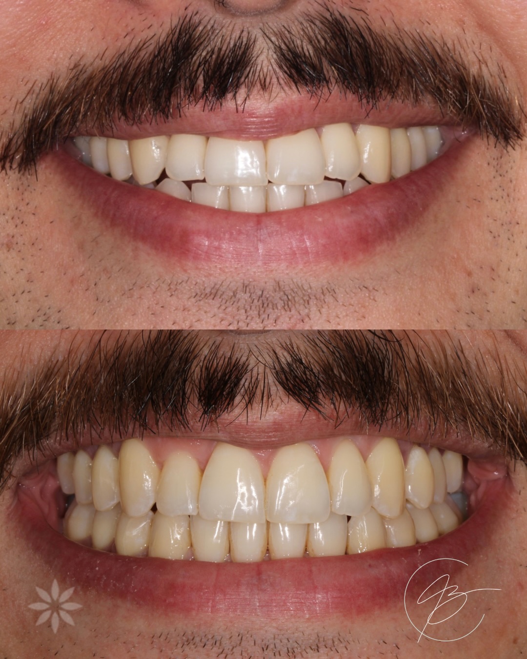 Resultado de tratamento odontológico — antes e depois